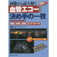 画像から読み解く血管エコー決め手の一枚　血管超音波検査の解剖・所見・原理・ピットフォール