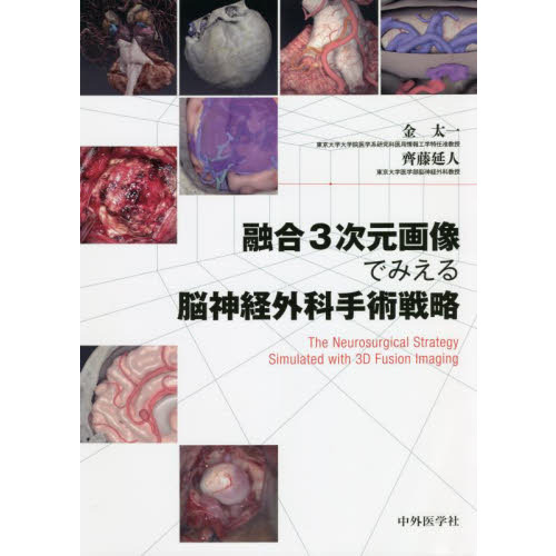 融合3次元画像でみえる脳神経外科手術戦略 通販｜セブンネット