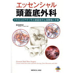エッセンシャル頭蓋底外科　イラストとビデオで学ぶ頭蓋底中心部腫瘍の手術