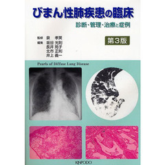 びまん性肺疾患の臨床　第３版　診断・管理