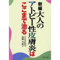 新編大人のアトピー性皮膚炎はここまで治る