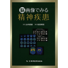 脳画像でみる精神疾患