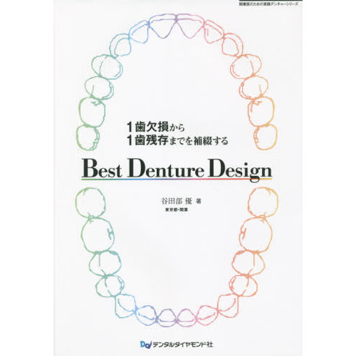 シエン社 | 1歯欠損から1歯残存までを補綴する Best Denture