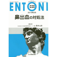 ＥＮＴＯＮＩ　Ｍｏｎｔｈｌｙ　Ｂｏｏｋ　Ｎｏ．２２８（２０１９年２月）　鼻出血の対処法
