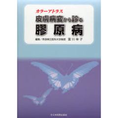皮膚病変から診る膠原病　カラーアトラス