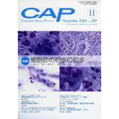 ＣＡＰ　２０９