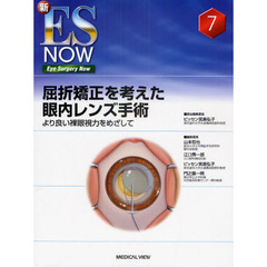 屈折矯正を考えた眼内レンズ手術　より良い裸眼視力をめざして