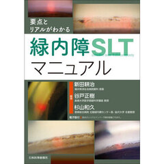 要点とリアルがわかる緑内障ＳＬＴマニュアル