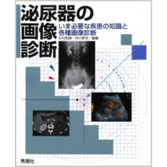 泌尿器の画像診断　いま必要な疾患の知識と各種画像診断