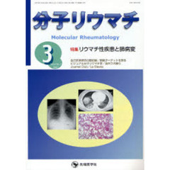 分子リウマチ　Ｖｏｌ．４Ｎｏ．１（２００７－３）　特集リウマチ性疾患と肺病変
