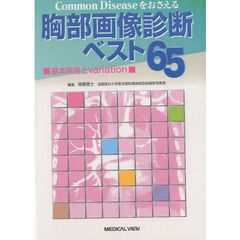 Ｃｏｍｍｏｎ　Ｄｉｓｅａｓｅをおさえる：胸部画像診断ベスト６５　基本所見とｖａｒｉａｔｉｏｎ