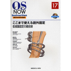 ここまで使える創外固定　低侵襲固定の最前線