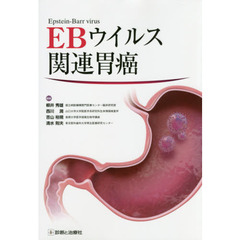 EBウイルス関連胃癌