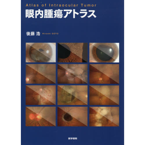 新版 眼内腫瘍アトラス (新品) 健康/医学 - kintarogroup.com