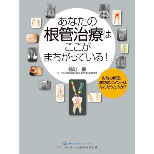 あなたの根管治療はここがまちがっている! | 鶴町 保 |本 | 通販