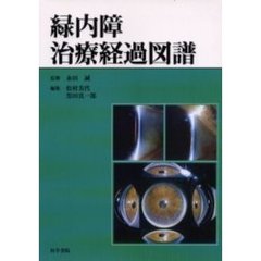 緑内障治療経過図譜