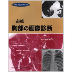必修胸部の画像診断