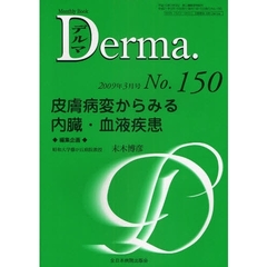 デルマ　Ｎｏ．１５０（２００９年３月号）　皮膚病変からみる内臓・血液疾患