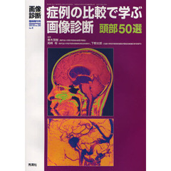 症例の比較で学ぶ画像診断頭部５０選