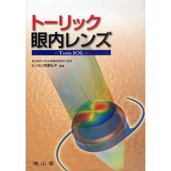 トーリック眼内レンズ