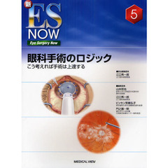 眼科手術のロジック　こう考えれば手術は上達する