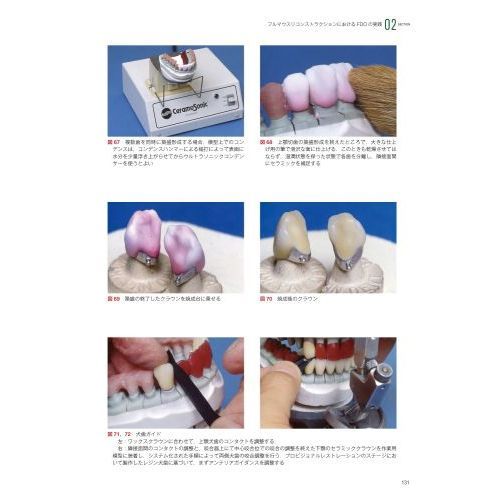 歯冠修復治療のテクニカルリクワイヤメント [新品]