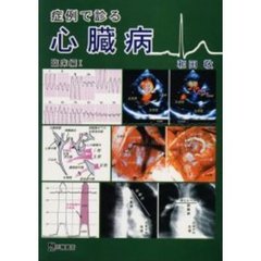 症例で診る心臓病　臨床編１