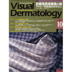 Ｖｉｓｕａｌ　Ｄｅｒｍａｔｏｌｏｇｙ　目でみる皮膚科学　Ｖｏｌ．６Ｎｏ．１０（２００７－１０）　〈特集〉炎症性皮膚疾患と眼　アトピー性皮膚炎を中心に