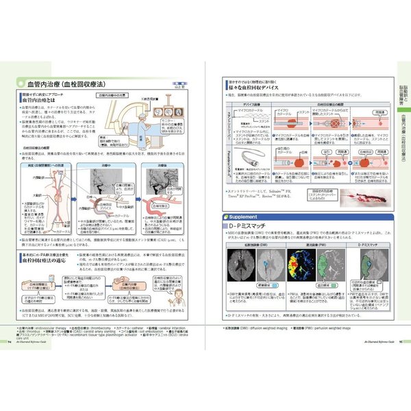 病気がみえる vol.7 脳・神経 - 健康・医学