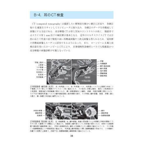 イラスト耳鼻咽喉科 第4版増補 通販｜セブンネットショッピング