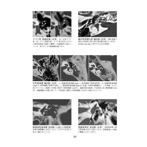 Amazon.co.jp: 耳鼻咽喉科学用語解説集 : 日本耳鼻咽喉科学会: 本