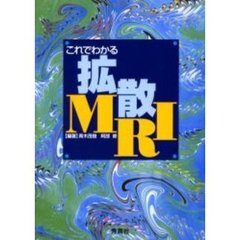 これでわかる拡散ＭＲＩ