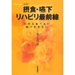 〈ルポ〉摂食・嚥下リハビリ最前線　口から食べたい食べさせたい