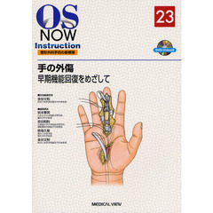 手の外傷　早期機能回復をめざして