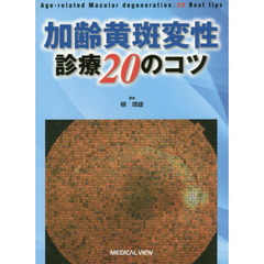 加齢黄斑変性診療２０のコツ