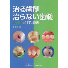 治る歯髄治らない歯髄　歯髄保存の科学と臨床
