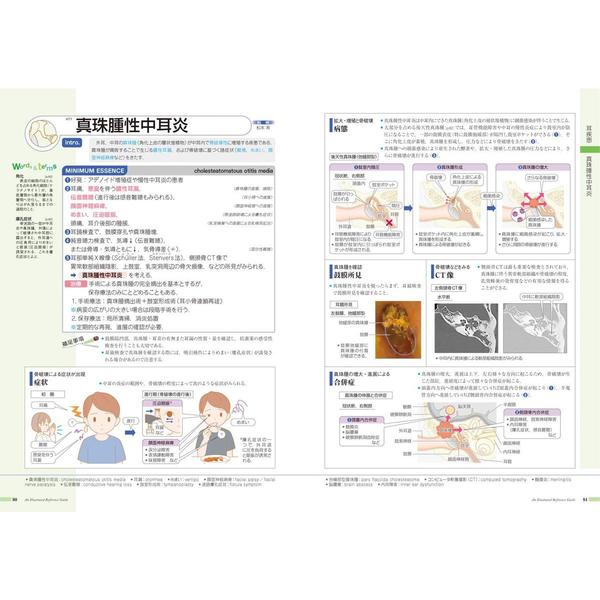 病気がみえるvol.13 耳鼻咽喉科　耳鼻咽喉科