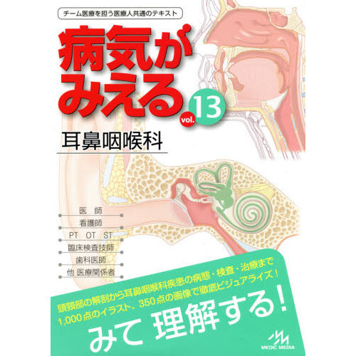 病気がみえるvol.13 耳鼻咽喉科 耳鼻咽喉科 通販｜セブンネット