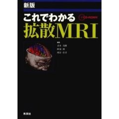 これでわかる拡散ＭＲＩ　新版