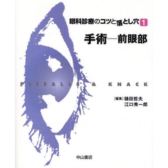 眼科診療のコツと落とし穴　１　手術－前眼部