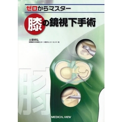 ゼロからマスター膝の鏡視下手術