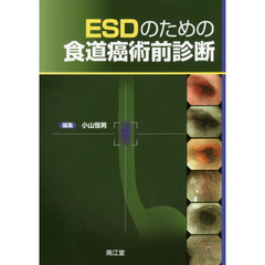 ＥＳＤのための食道癌術前診断