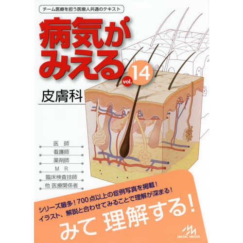 病気がみえる vol.14 皮膚科 皮膚科 通販｜セブンネットショッピング