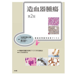 造血器腫瘍