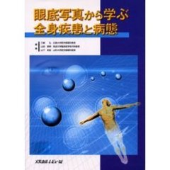 眼底写真から学ぶ全身疾患と病態