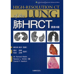 肺ＨＲＣＴ