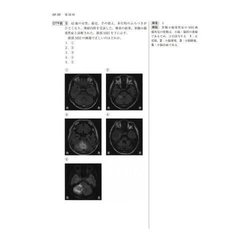理学療法士・作業療法士国家試験問題解答と解説 第54－58回