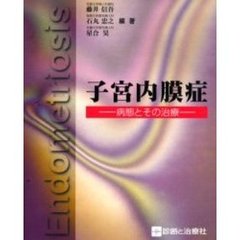 子宮内膜症　病態とその治療