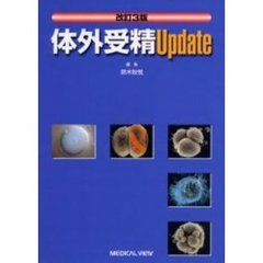 体外受精Ｕｐｄａｔｅ　改訂３版