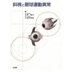 斜視と眼球運動異常